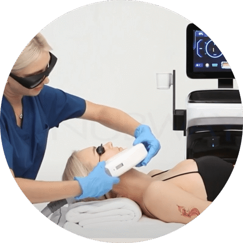 Portable IPL Machine - Image 2