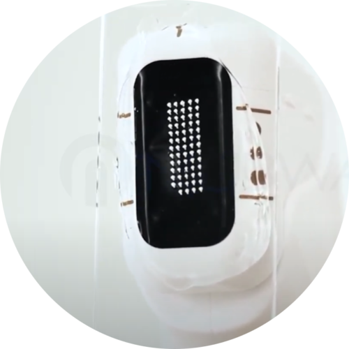 Portable HIFU Machine - Image 3