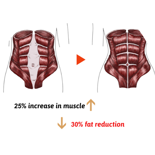 Portable EMS+RF - Image 3