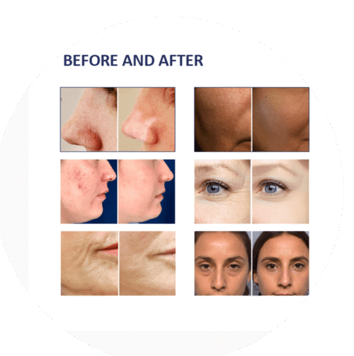 Multifunctional Skin Care Platform 9 in 1 Machine - Image 4