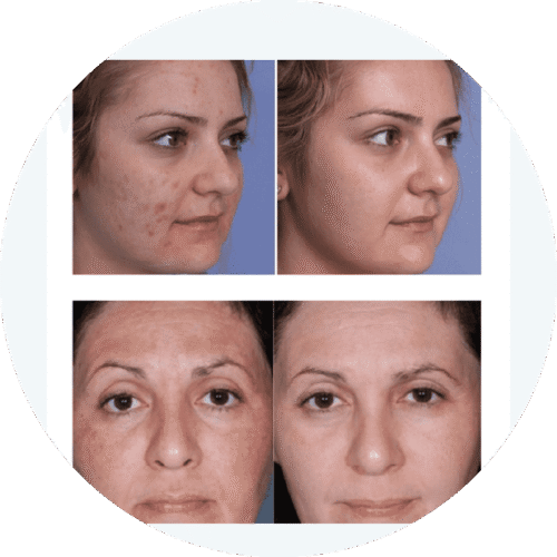 PDT Led Light Therapy Machine - Image 6