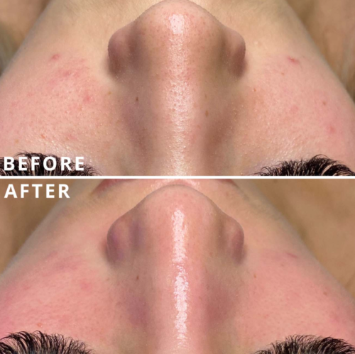 HiSkin 9-in-1 Multifunctional Skin Care Platform - Image 23