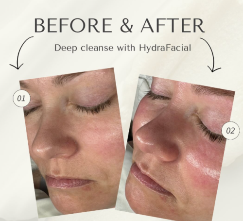 HiSkin 9-in-1 Multifunctional Skin Care Platform - Image 24