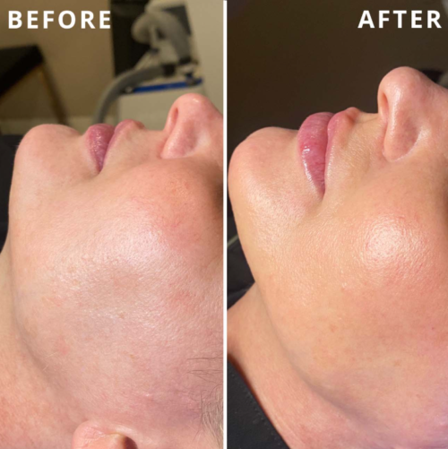 HiSkin 9-in-1 Multifunctional Skin Care Platform - Image 26