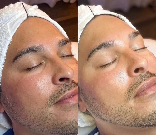 HiSkin 9-in-1 Multifunctional Skin Care Platform - Image 16