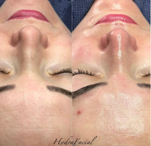 HiSkin 9-in-1 Multifunctional Skin Care Platform - Image 19