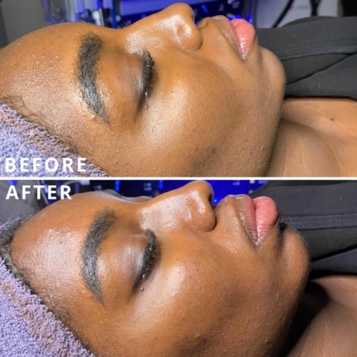 HiSkin 9-in-1 Multifunctional Skin Care Platform - Image 20