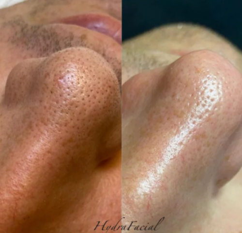 HiSkin 9-in-1 Multifunctional Skin Care Platform - Image 22